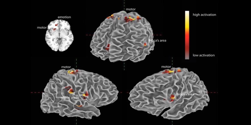 Musica e cervello. Guarda come le note eccitano i neuroni